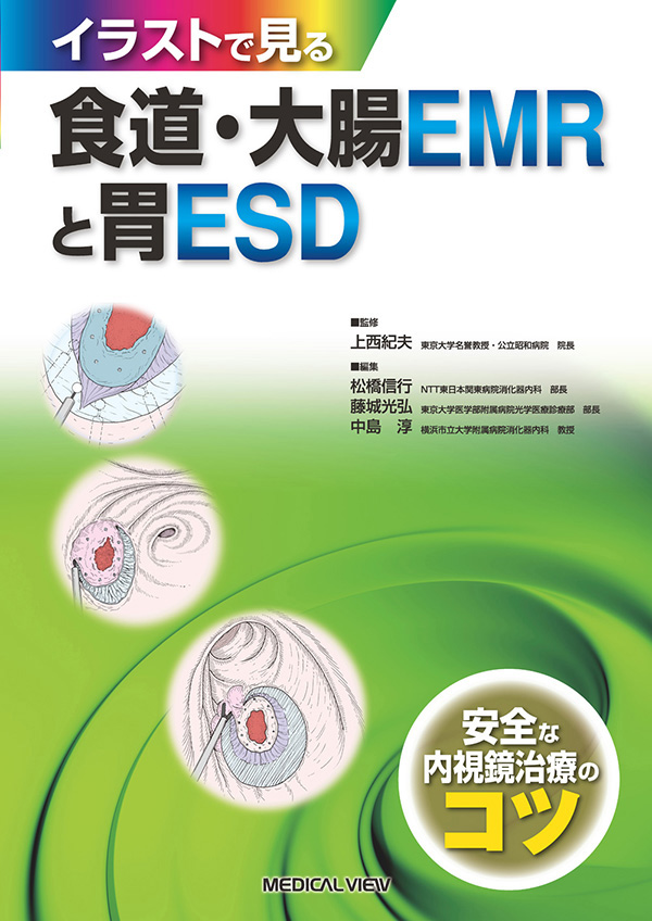 食道・大腸EMRと胃ESD