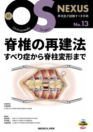 脊椎の再建法—すべり症から脊柱変形まで［Web動画付］