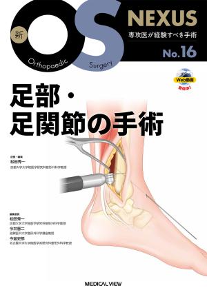 足部・足関節の手術［Web動画付］