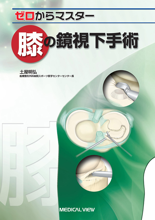 膝の鏡視下手術