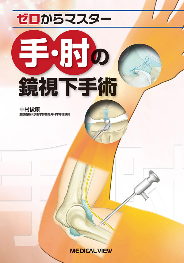 手・肘の鏡視下手術