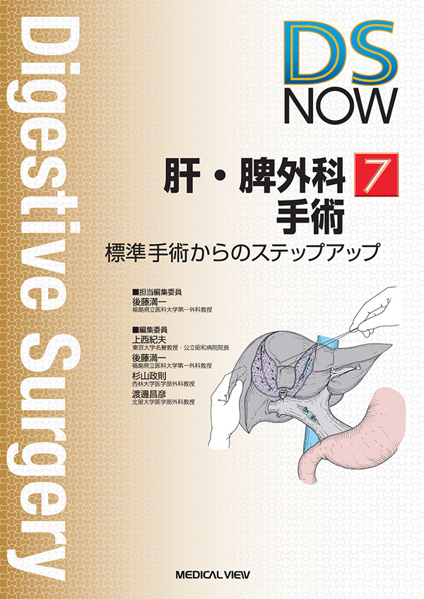 肝・脾外科手術