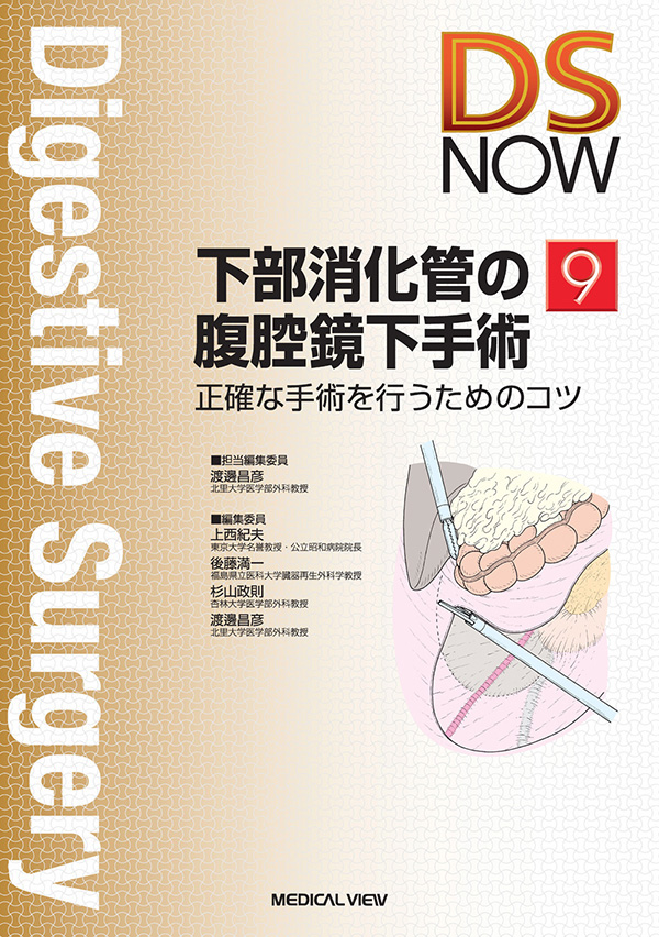 下部消化管の腹腔鏡下手術