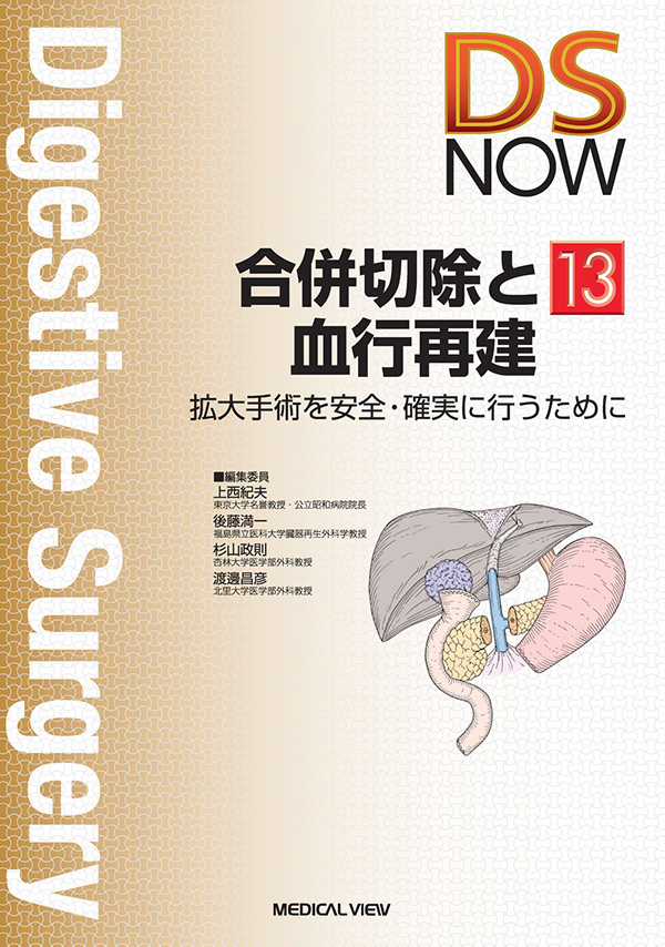 合併切除と血行再建