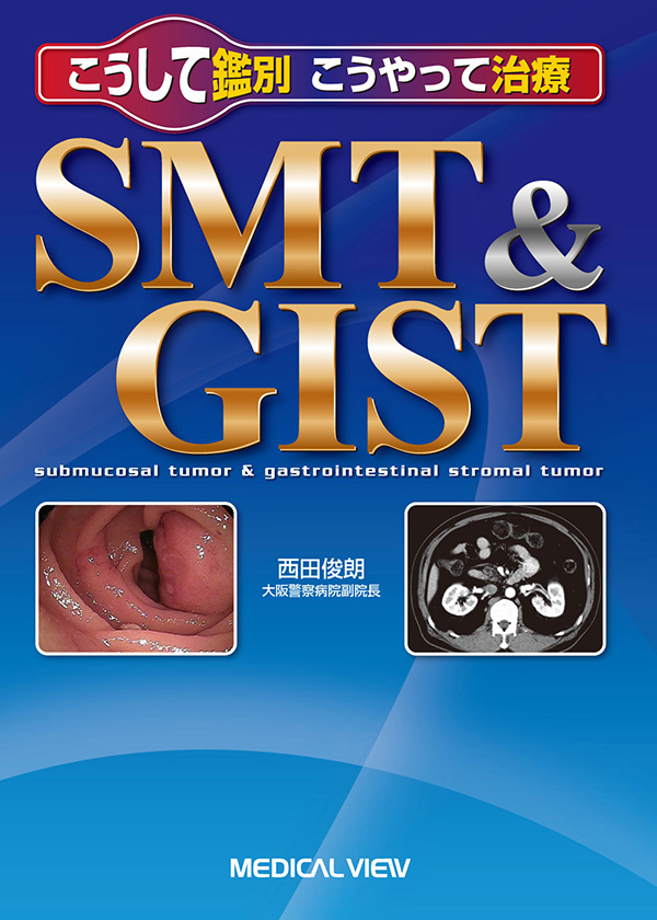 SMT & GIST