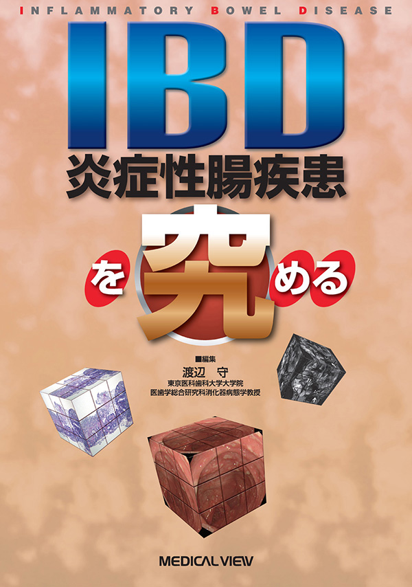 IBD(炎症性腸疾患)を究める