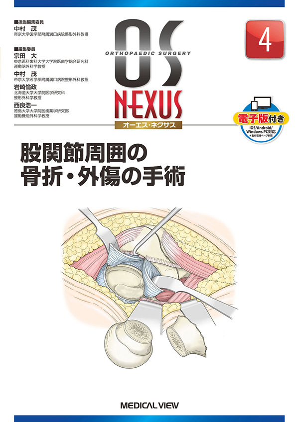 メジカルビュー社 整形外科 Os Nexus 電子版付き 4 股関節周囲の骨折 外傷の手術