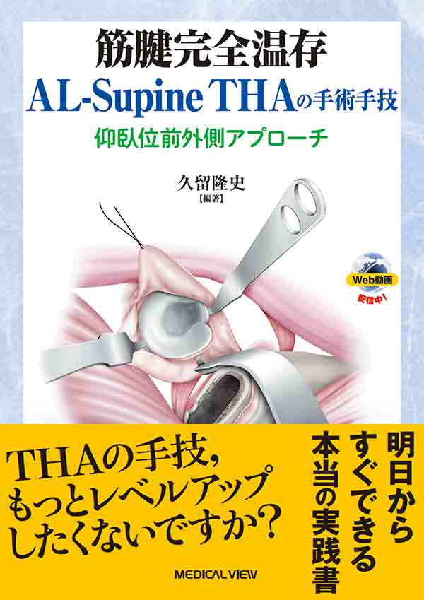 筋腱完全温存AL-Supine THAの手術手技［Web動画付］