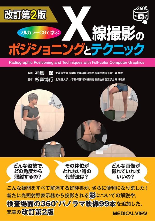 X線撮影のポジショニングとテクニック