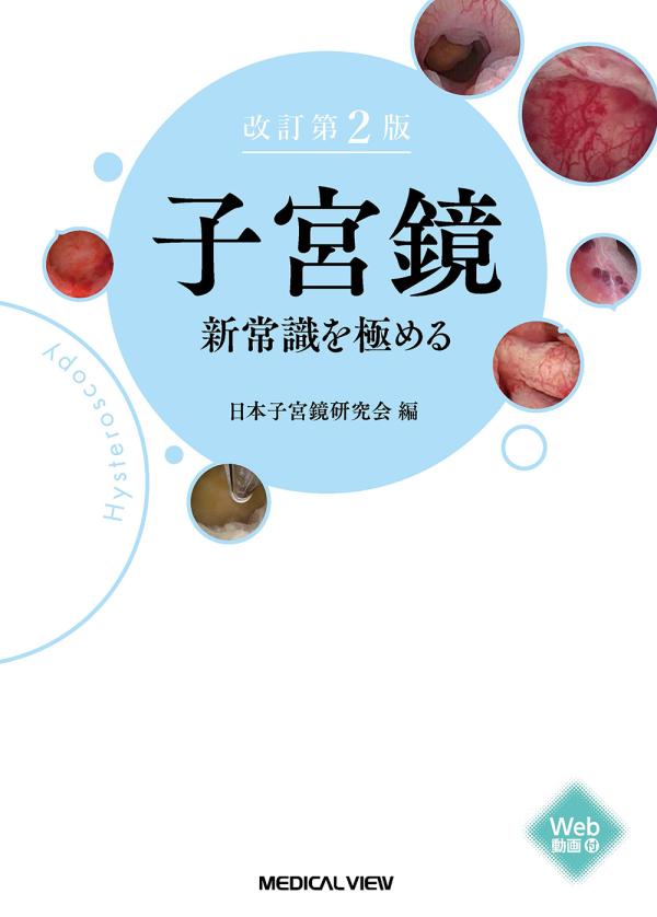 子宮鏡　新常識を極める