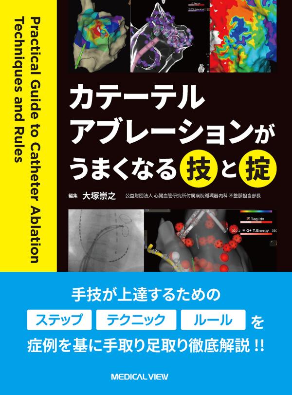 カテーテルアブレーションがうまくなる技と掟