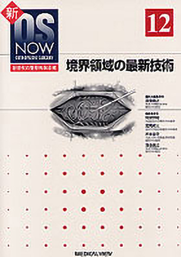 境界領域の最新技術