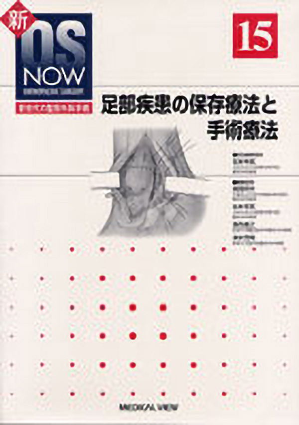 足部疾患の保存療法と手術療法