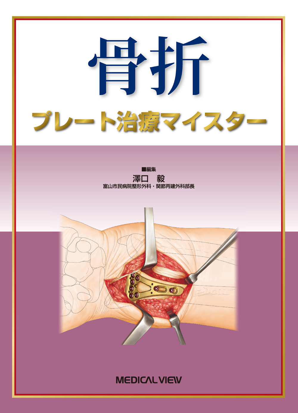 メジカルビュー社 整形外科 骨折 プレート治療マイスター