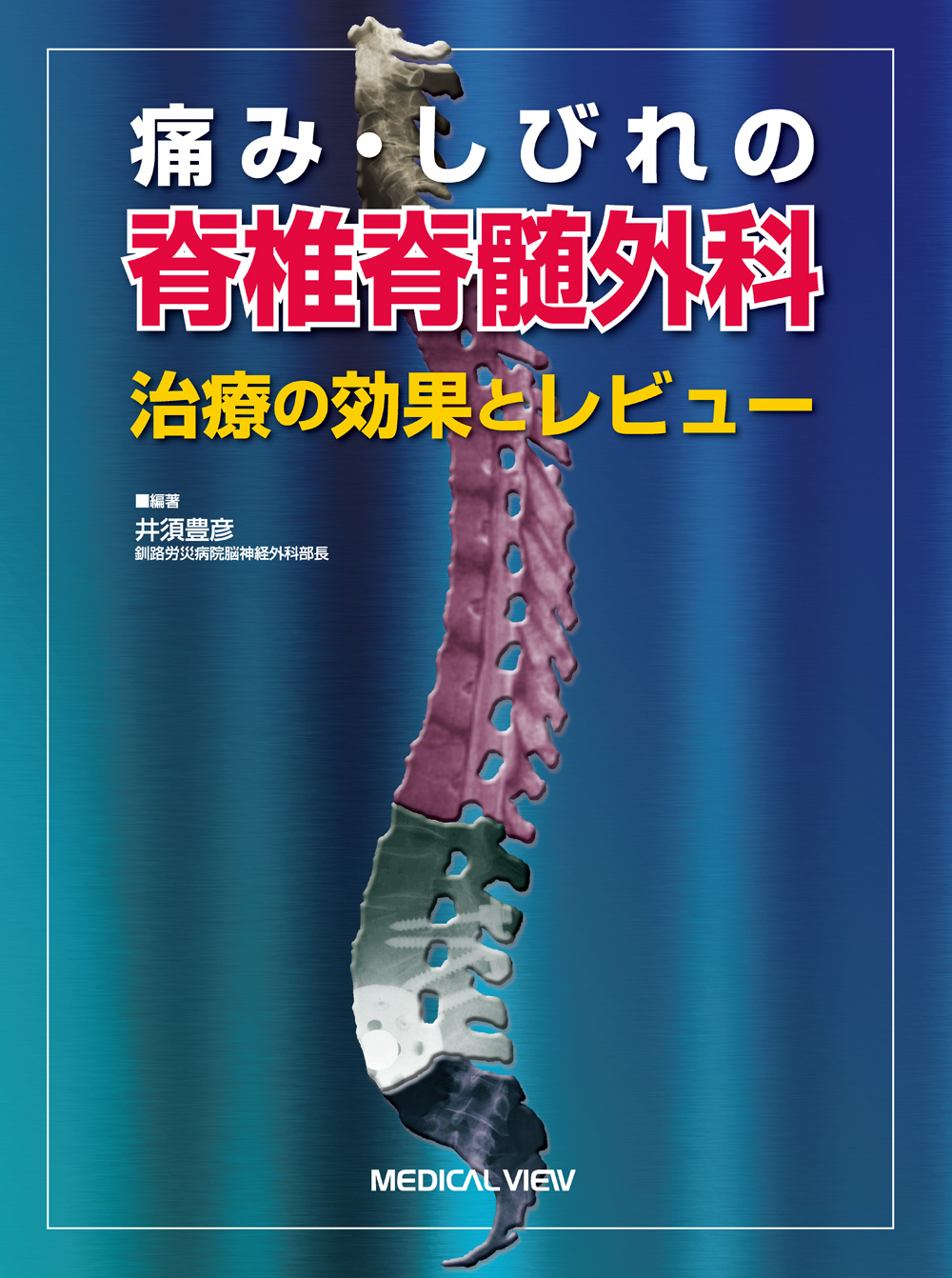 メジカルビュー社｜脳神経外科｜痛み・しびれの脊椎脊髄外科