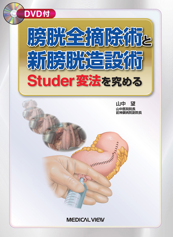 メジカルビュー社｜癌・腫瘍・緩和ケア｜膀胱全摘除術と新膀胱造設術