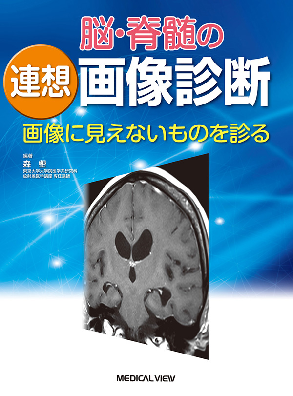 メジカルビュー社｜画像医学・放射線医学｜脳・脊髄の連想画像診断