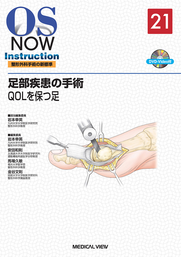 ☆大人気商品☆ 【中古】 新OS now no.21 新世代の整形外科手術 