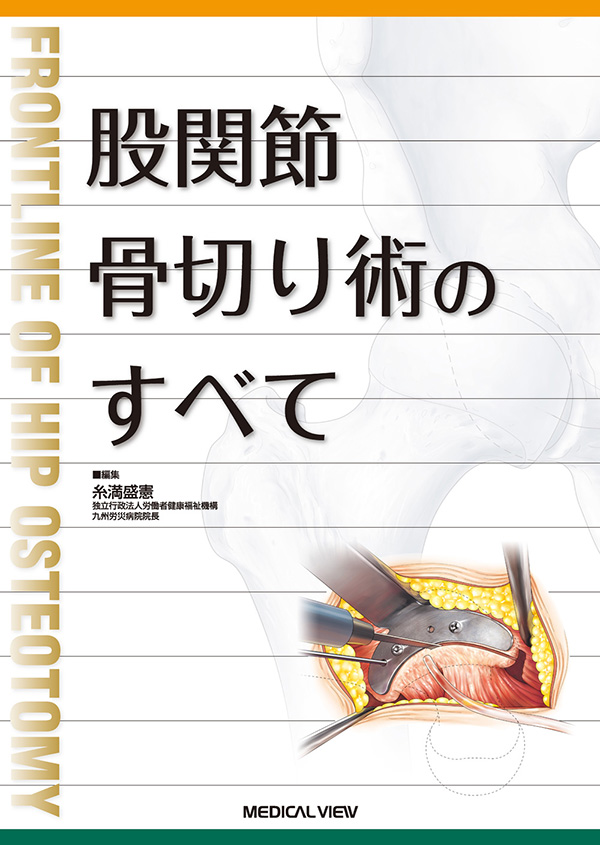 メジカルビュー社｜整形外科｜股関節骨切り術のすべて