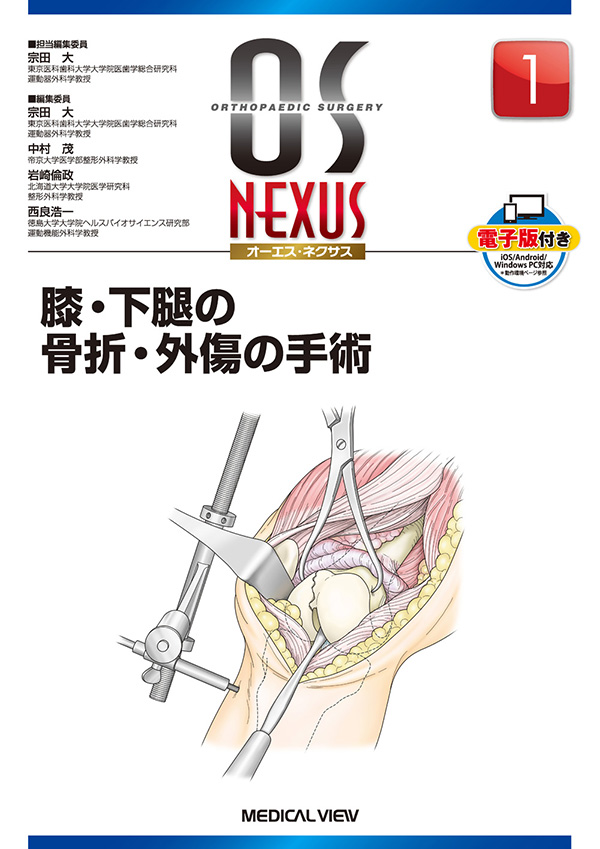 整形外科　膝・下腿の骨折・外傷の手術　OS NEXUS