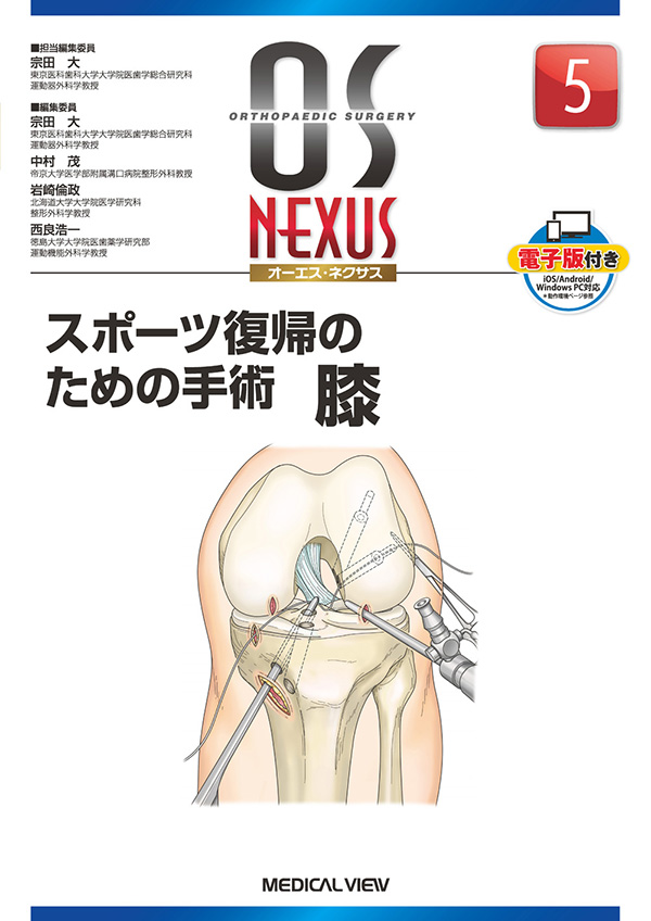 膝 形態・機能と靭帯再建術