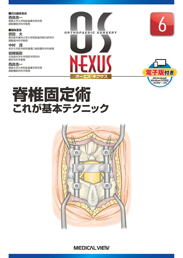 メジカルビュー社｜整形外科｜OS NEXUS（電子版付き） 6 脊椎固定術 