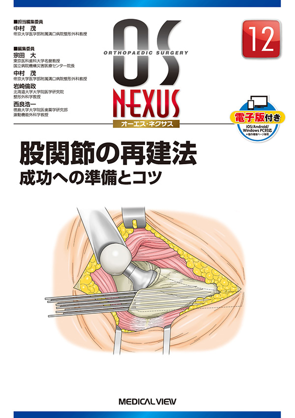 メジカルビュー社｜整形外科｜OS NEXUS（電子版付き） 12 股関節の再建法