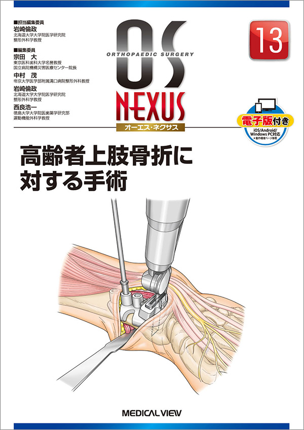 低価新作登場 スタンダード骨折手術治療上肢 9ndWY-m68679784970