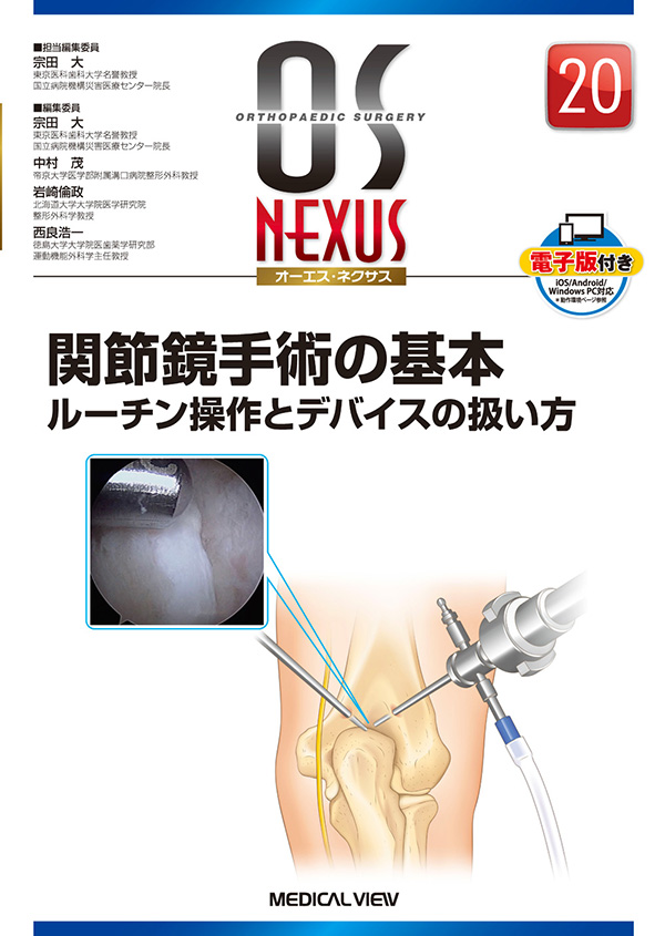 メジカルビュー社｜整形外科｜OS NEXUS（電子版付き） 20 関節鏡手術の基本