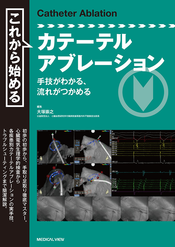 メジカルビュー社｜循環器内科｜これから始めるカテーテルアブレーション