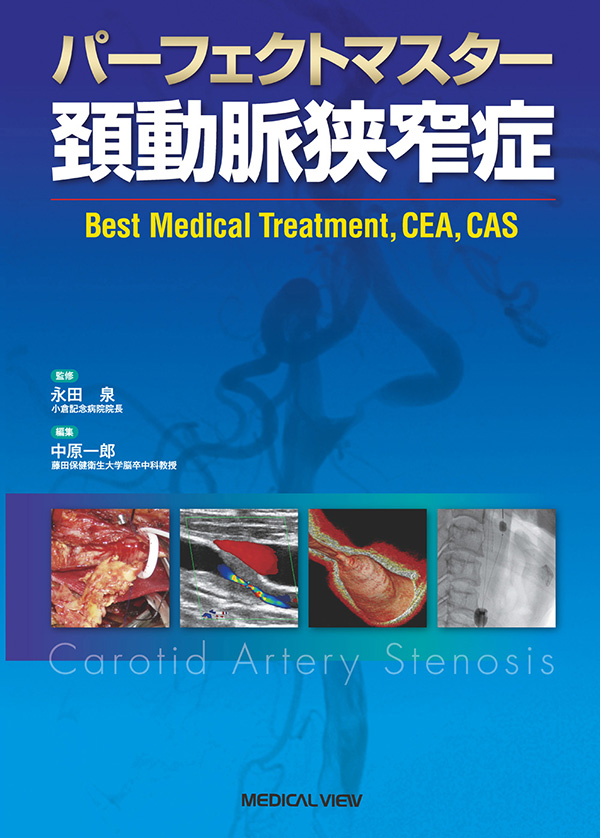 メジカルビュー社｜脳神経内科・精神医学｜パーフェクトマスター 頚動脈狭窄症