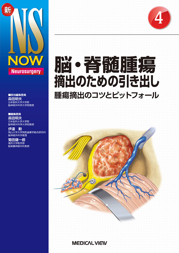 メジカルビュー社｜脳神経外科｜新NS NOW 4 脳・脊髄腫瘍摘出の 