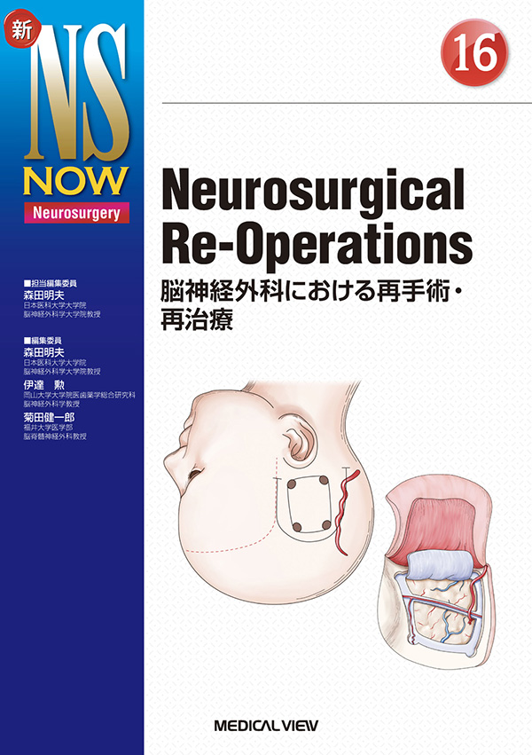 メジカルビュー社｜脳神経外科｜新NS NOW 16 Neurosurgical Re 
