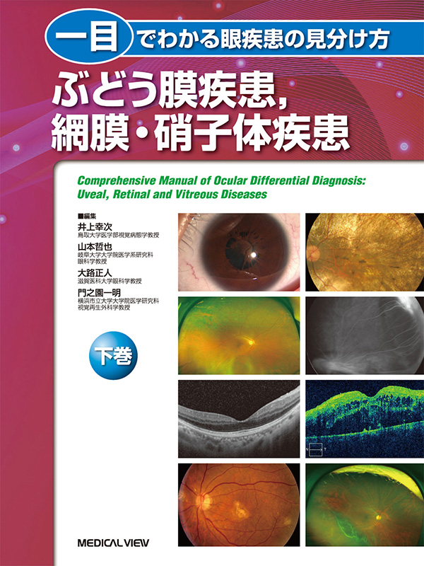 全国販売 一目でわかる眼疾患の見分け方 上巻[本/雑誌] / 井上幸次