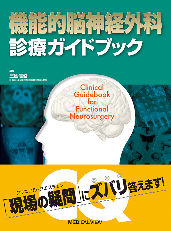 メジカルビュー社｜脳神経外科｜機能的脳神経外科 診療ガイドブック