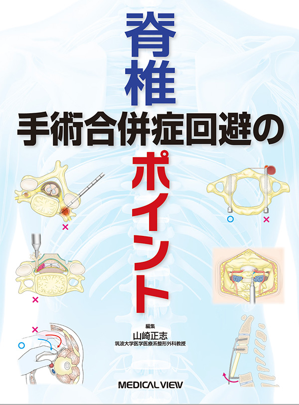 メジカルビュー社｜整形外科｜脊椎手術合併症回避のポイント