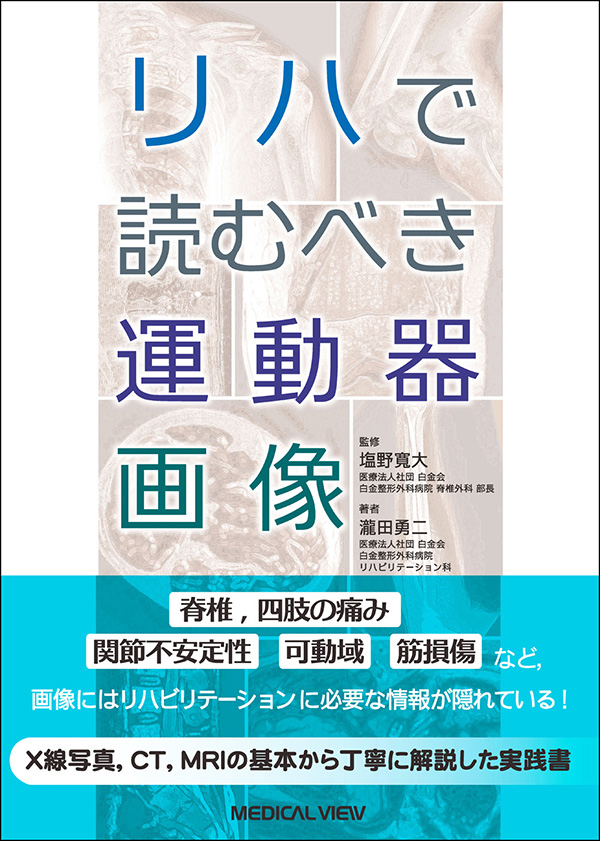 メジカルビュー社｜作業療法士｜リハで読むべき運動器画像