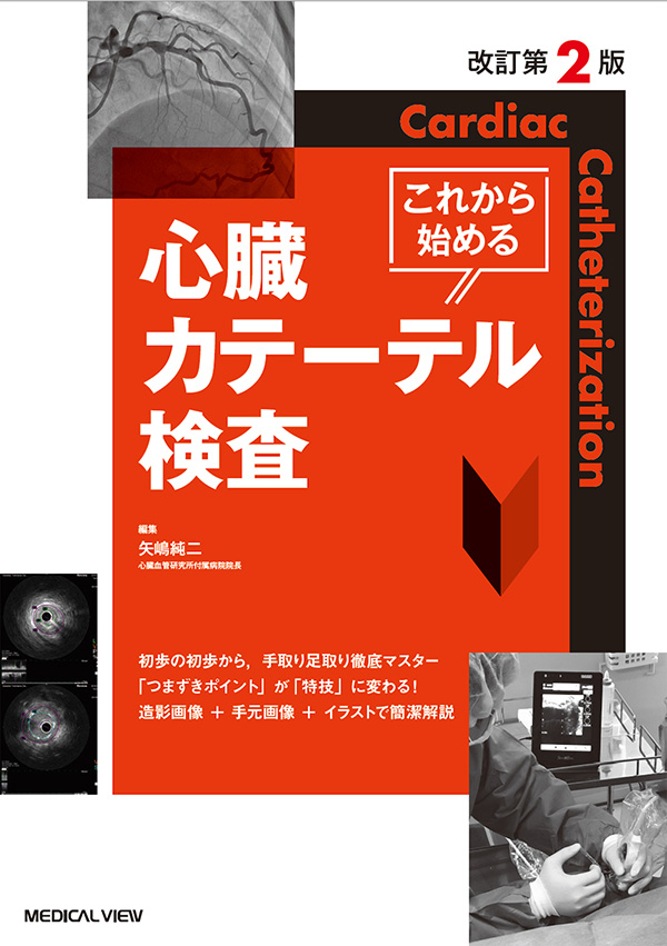 メジカルビュー社｜循環器内科｜これから始める心臓カテーテル検査