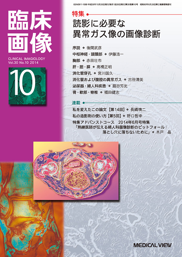 臨床画像 2014年10月号