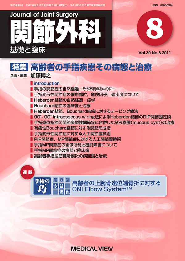 関節外科 2011年8月号