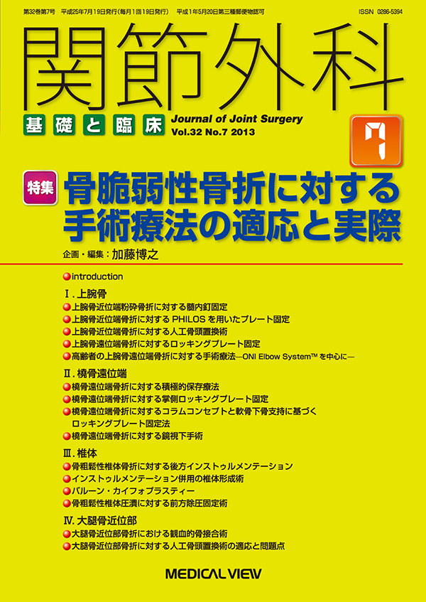関節外科 2013年7月号