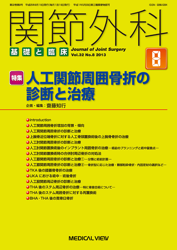 関節外科 2013年8月号