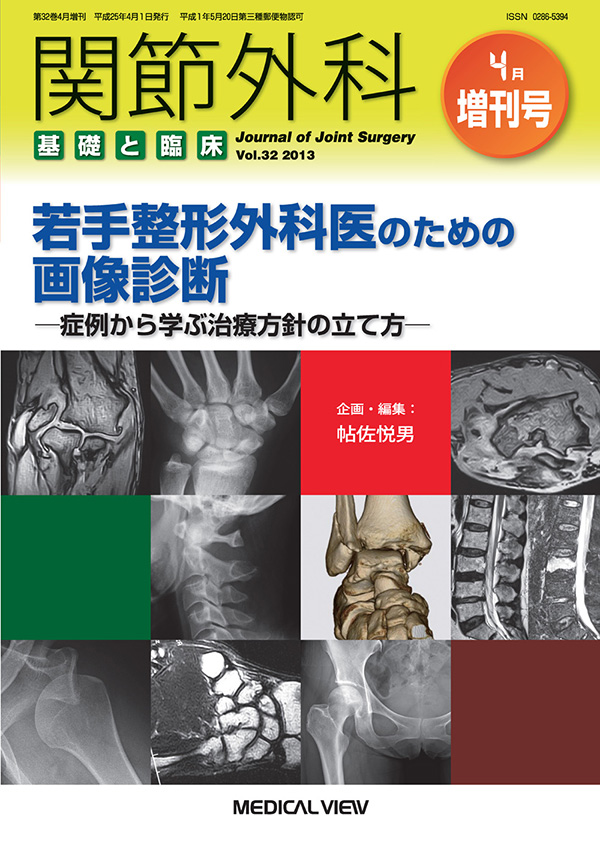 関節外科 2013年4月増刊号